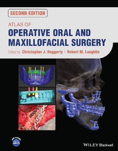 Atlas of Operative Oral and Maxillofacial Surgery (2nd Edition) - PDF